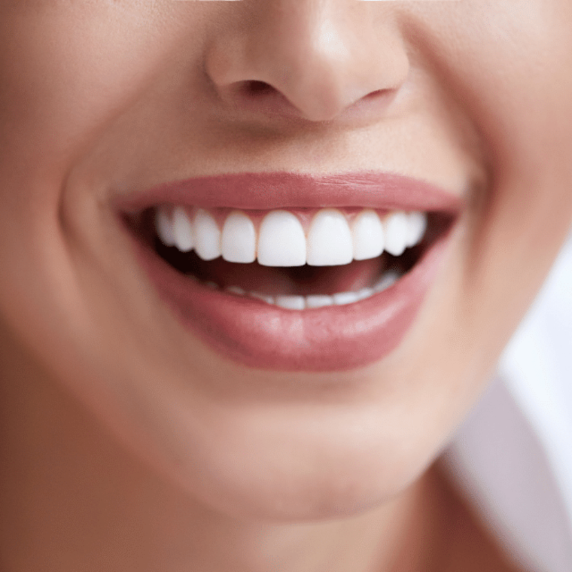 O que significa sonhar com dente branco? Bonito, sujo, caindo e mais! 