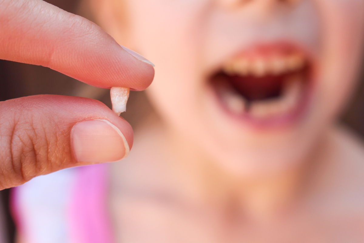 Em primeiro plano, pessoa com dente de leite na mão; em segundo plano, criança sem o dente mole que caiu.