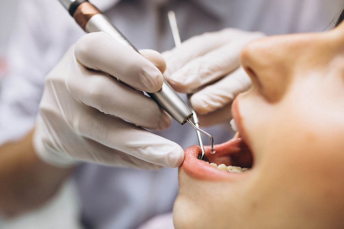 Mulher no dentista consertando dente quebrado