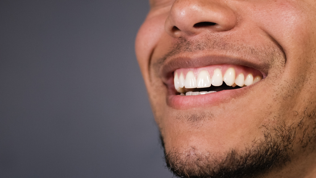 Homem sorrindo e mostrando a gengiva.