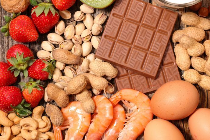 Alimentos que causam alergia como camarão e chocolate